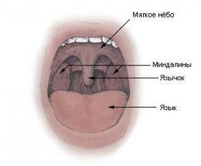 Kto a prečo je nutné odstrániť mandle