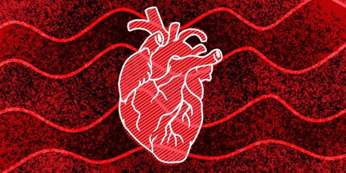 11 znamenie, že môžu vzniknúť zástavu srdca