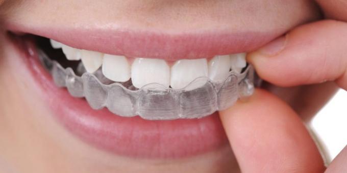 Škrípanie zubov: ochranný kryt
