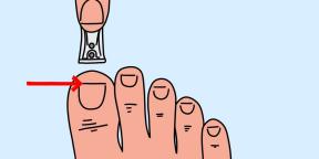 Čo spôsobuje zlé ostrihať nechty a ako sa vyhnúť zdravotným problémom