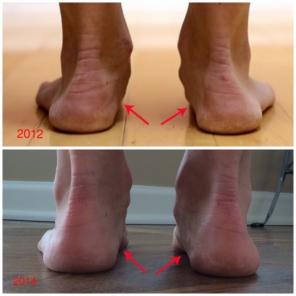 Ako spustiť v minimalistickej topánky zmena nohy