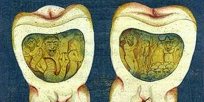 Stredoveká medicína: Stránka z osmanského zubného spisu, 17. storočie.