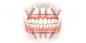 Ako obnoviť zuby a usmiať